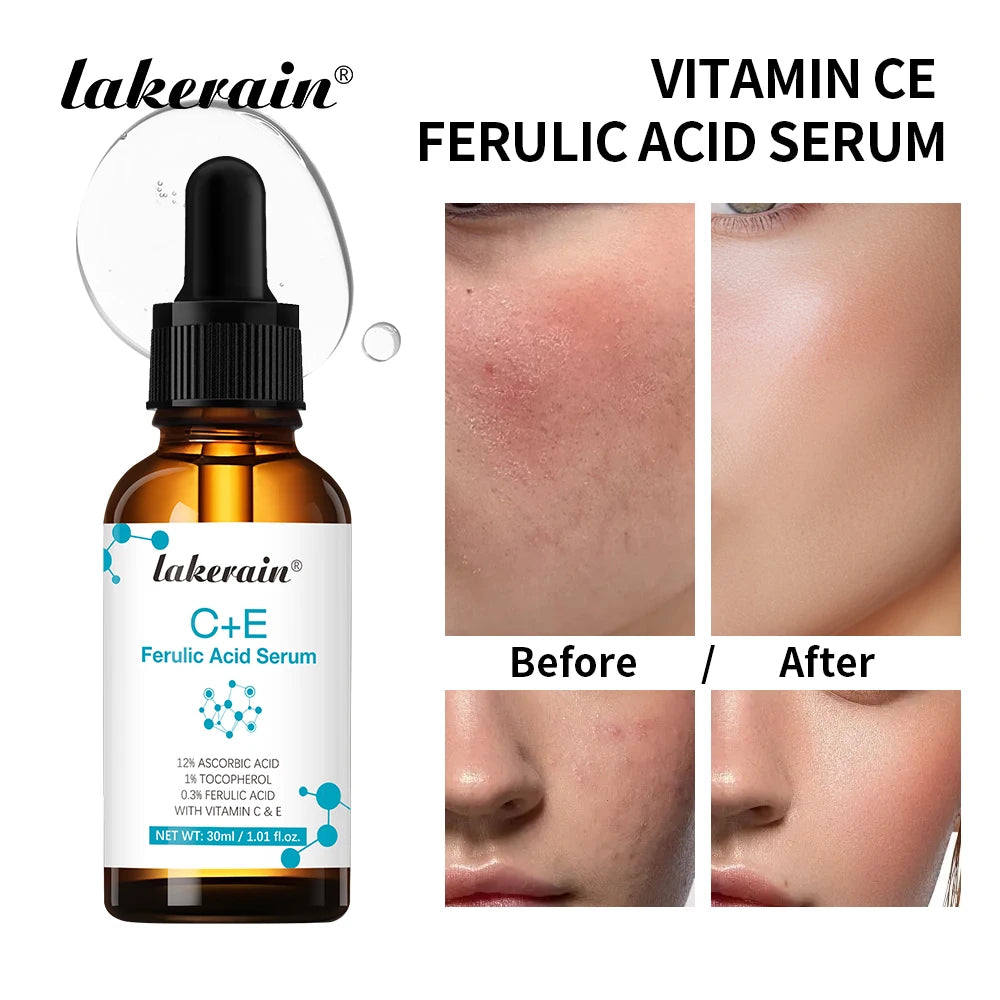 Sérum Vitamine C Anti-Taches — Éclat & Hydratation